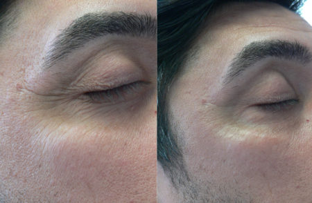 Dr. Lanfermann Ageless Eye Gel